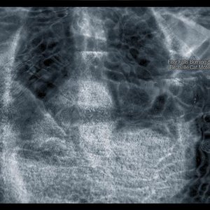 fear falls burning & birchville cat motel 的头像