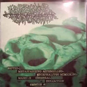 Septic-Metastasizing Aspergillus-Encephalitus Mimicking Massive Cerebral Infarction Session #1