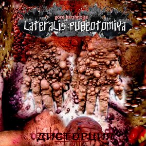 LATERALIS PUBEOTOMIYA 的头像