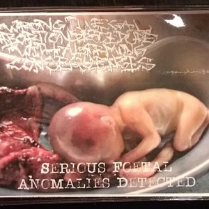 Serious Foetal Anomalies Detected