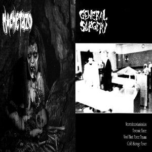 General Surgery / Machetazo