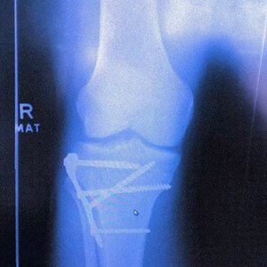 Gglum - Things You Said - Zortam Music