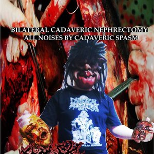 Avatar for Bilateral Cadaveric Nephrectomy