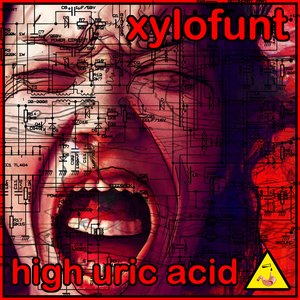 High Uric Acid