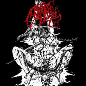 Spiraling Induced Barbedwire Lacerations