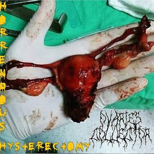 Horrendous Hysterectomy