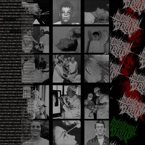 Legalize lobotomy