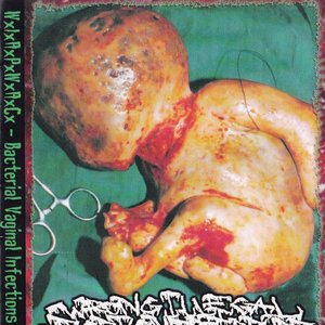 Bacterial Vaginal Infections In Pregnancy