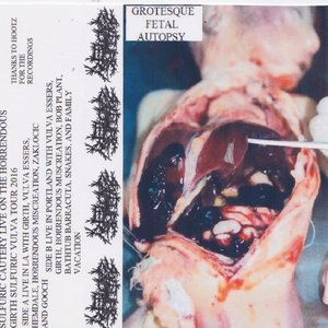 Grotesque Fetal Autopsy
