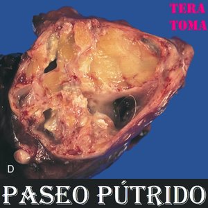 Paseo pútrido