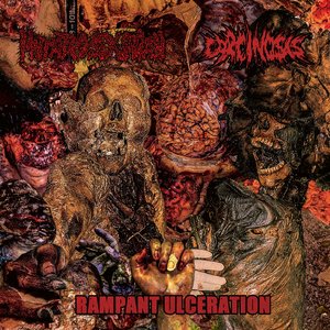 Rampant Ulceration