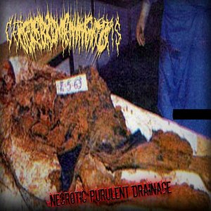 NECROTIC PURULENT DRAINAGE