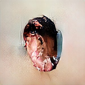 blunt trauma