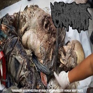 Advanced Decomposition of Highly Decompressed Human Body Parts