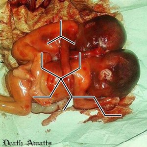 Sodium Thiopental 的头像