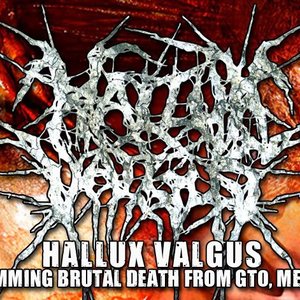 Avatar für Hallux Valgus