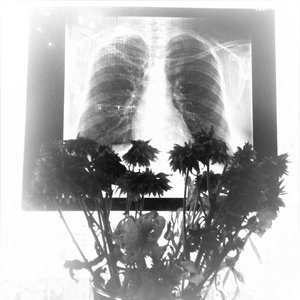diaphragma