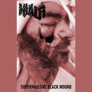 Supermassive Black Wound