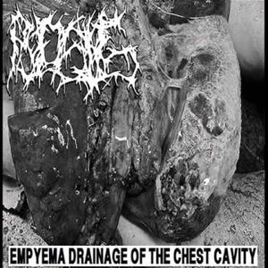 Empyema Drainage Of The Chest Cavity