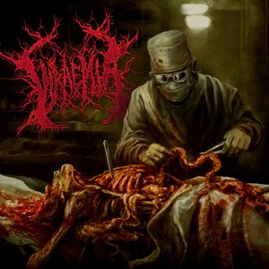 Viraemia