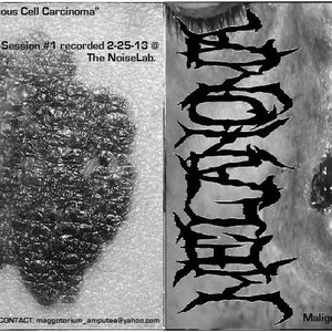 Avatar di Melanoma