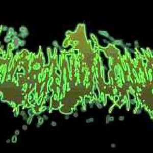 Avatar for Lymphogranulomatosis