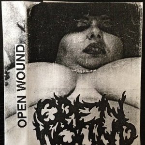 Open Wound