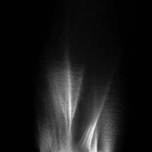 Caustics