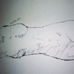 Aorta, Etc