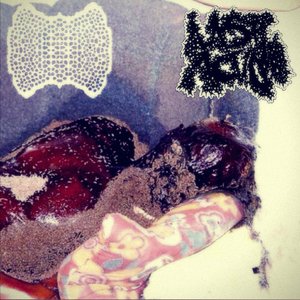 Rotting After a Tormentuous Liver Dissection
