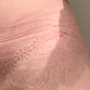 intimacy issues