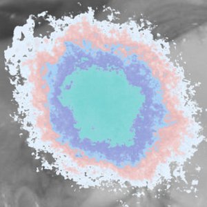 Avatar für Asystole from Thrombosis