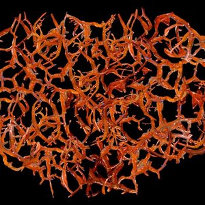 Avatar for Perforation of the Gastrointestinal Tract
