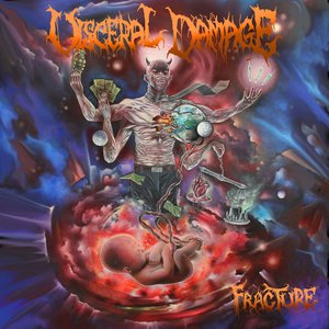 Fracture