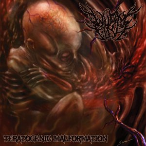 Teratogenic Malformation