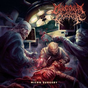 Micro Surgery - EP