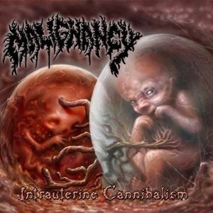 Intrauterine Cannibalism [Explicit]