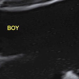 Boy