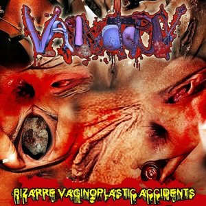 Vaginotopsy Profile Picture