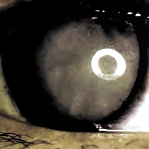 Stare