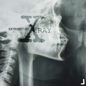 X-Ray