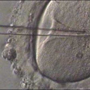 Avatar för Sperm Injection