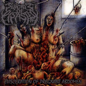 Evisceration Of Pregnant Abdomen