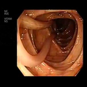 Good Colonoscopy