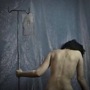 Patient 58 - Single