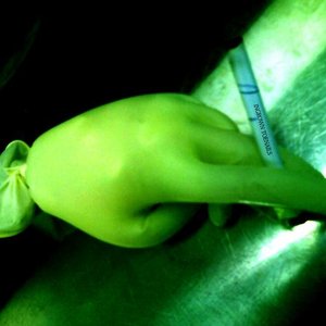 Ingrown Toenails 的头像