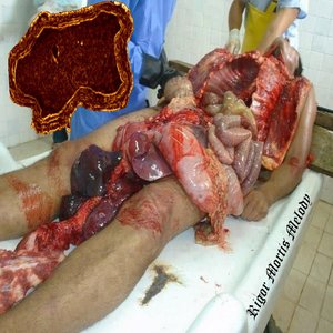 Rigor Mortis Melody