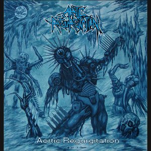 Aortic Regurgitation