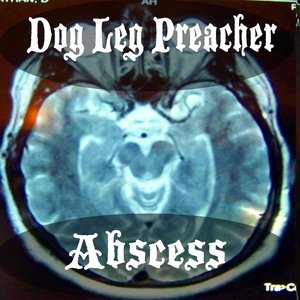 Abscess