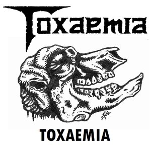 Toxaemia - Single